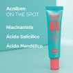 Gel Corretor Rosto Anti-Acne Isdin Acniben On The Spot 15 ml Gel Corretor Rosto Anti-Acne Isdin Acniben On The Spot 15 ml