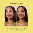 Isdin Acniben CC+ Cream Bronze SPF30 40ml | Pele Oleosa e com Tend�ncia Acneica