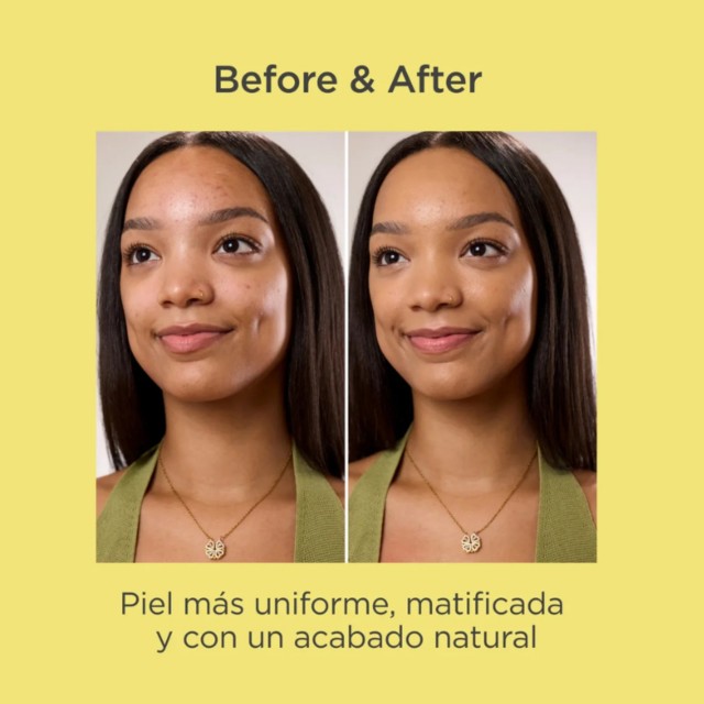 Isdin Acniben CC+ Cream Bronze SPF30 40ml | Pele Oleosa e com Tend�ncia Acneica