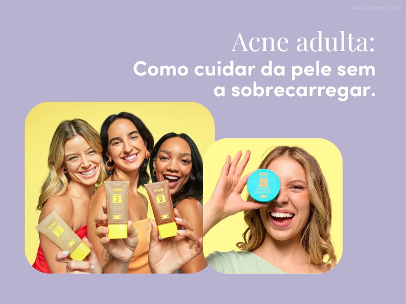 Acne adulta: como cuidar da pele sem a sobrecarregar Acne adulta: como cuidar da pele sem a sobrecarregar